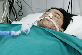 Tình yêu hay sự thù hận?