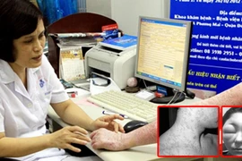 Thảm hại vì đem mặt ra làm “chuột bạch”