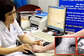 Thảm hại vì đem mặt ra làm “chuột bạch”