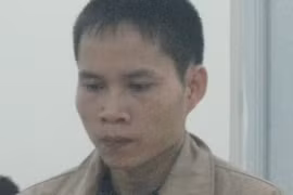 Cứa cổ người tình vì “ăn tát” trước đám đông