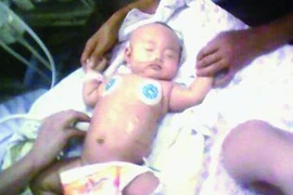 Phát hiện 4 cây kim trong người bé 2 tháng tuổi