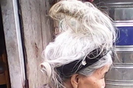 Vì sao con người lại mọc sừng?