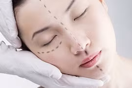 Phẫu thuật chỉnh hình khó tăng quyến rũ