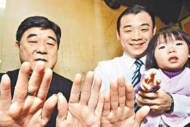 Người không có dấu vân tay