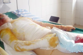 Người yêu không chịu cưới, tẩm xăng đốt cả đôi