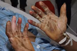 Ăn tiết canh lấy “đỏ”, bỏ mạng