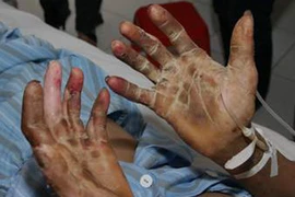 Ăn tiết canh lấy “đỏ”, bỏ mạng