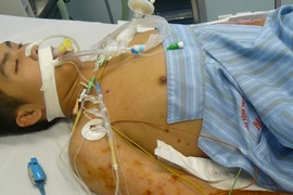 Vi khuẩn “ăn thịt người” xuất hiện ở Việt Nam từ năm 2009