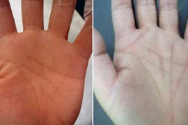 Vẽ lại đường chỉ tay, mong vận đỏ