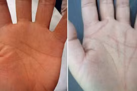 Vẽ lại đường chỉ tay, mong vận đỏ