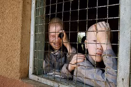 Tanzania: Nghi án chính trị gia mua chân tay người bạch tạng làm bùa may mắn