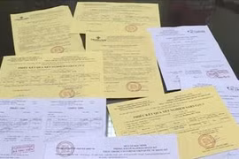 Nhà xe câu kết thợ ảnh sản xuất giấy test nhanh Covid