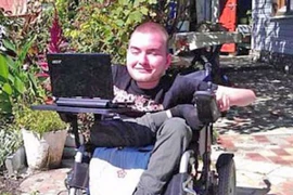 Người đầu tiên tình nguyện ghép đầu