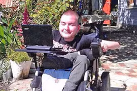 Người đầu tiên tình nguyện ghép đầu