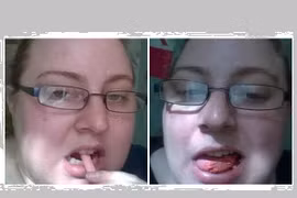 Người phụ nữ nghiện ăn phấn hơn cả sex