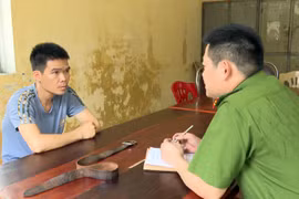 Bắt giam 'gã' chồng vũ phu hành hạ vợ đang mang thai với gần 70 vết bỏng trên khắp cơ thể