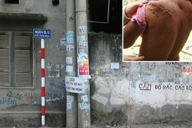 Hoảng loạn vì kẻ giấu mặt chuyên rạch lưng thiếu nữ