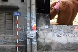 Hoảng loạn vì kẻ giấu mặt chuyên rạch lưng thiếu nữ