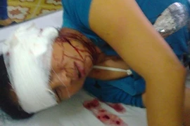 Chém đứt tai vợ, dọa chặt đôi người chồng