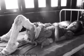 Bị nhà chồng thiêu sống vì không nộp đủ của hồi môn