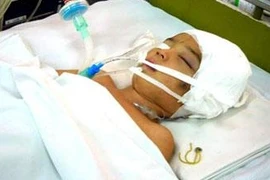Chấn thương sọ não vì tai nạn hi hữu