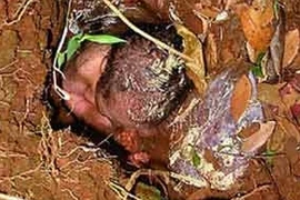 Bị mẹ đẻ chôn sống, bé trai 1 ngày tuổi thoát chết kỳ diệu