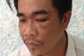 Giả làm khách đến chúc Tết, trộm tiền rồi tẩu thoát