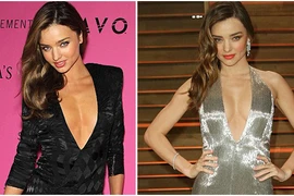 "Thiên thần nội y" bị dính nghi án nâng ngực