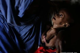 Xót xa cảnh đói ở Somali