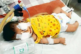 Xót thương, bé gái 3 tháng tuổi bị cha đẻ hành hạ đến chết