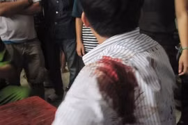 Côn đồ dùng súng bắn người giữa đường