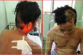 5 thanh niên vô cớ truy sát dã man người đàn ông trong đêm