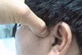 Đình chỉ một thầy lang chữa bệnh "vỗ tai", "bẻ lưỡi" kỳ quặc