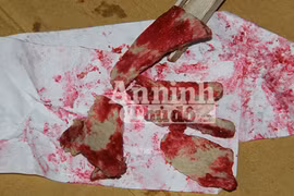 Thịt lợn chín chuyển màu đỏ do nhiễm khuẩn Serratia Marcescens