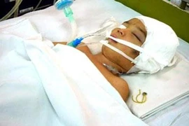 Chấn thương sọ não ở trẻ nhỏ - Hiểm họa khôn lường
