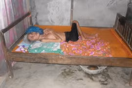 Xót lòng cụ bà bại não nằm liệt giường