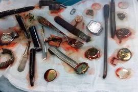 Nuốt cả mớ đồ ăn trộm để khỏi vào tù