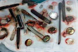 Nuốt cả mớ đồ ăn trộm để khỏi vào tù