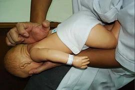 Bé 8 tháng tuổi bị tổn thương não do...sặc cháo