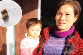 Hy hữu vụ cho trẻ uống nhầm vitamin A bằng... hạt đậu giống