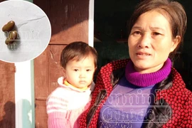 Hy hữu vụ cho trẻ uống nhầm vitamin A bằng... hạt đậu giống