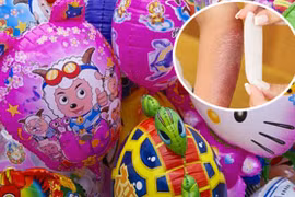 Hậu họa khôn lường từ những chùm bóng bay sặc sỡ