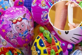 Hậu họa khôn lường từ những chùm bóng bay sặc sỡ