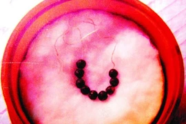 Bí ấn 9 hạt xá lị Phật hoàng Trần Nhân Tông