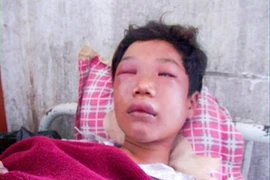 Ông ngoại đánh cháu dã man vì mất chiếc Huân chương