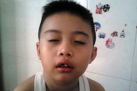 Rối mù vụ cô giáo "lỡ tay" làm gãy răng, giập miệng học sinh