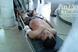 Một thanh niên bị ảo đá dùng kéo đâm hàng xóm