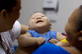 Hơn 91.000 ca nghi mắc Zika tại Brazil