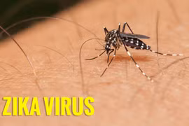 Ca tử vong đầu tiên do virus Zika ở Mỹ
