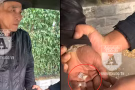 [CLIP] Giấu heroin, đối tượng nói dối là... thuốc đau chân